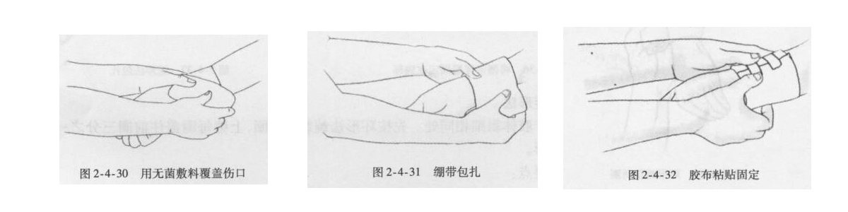 醫用繃帶環(huán)形包扎法.jpg